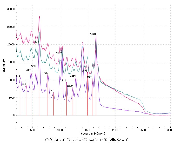 圖5 3例結(jié)石拉曼光譜.jpg